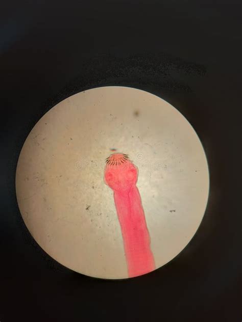 Microscopic View of Tapeworm Stock Image - Image of head, pink: 233119561