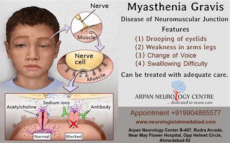 Is Magnesium Bad For Myasthenia Gravis