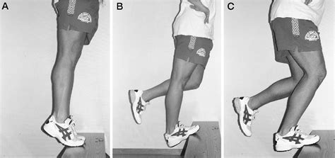 Structure of achilles tendon | Semantic Scholar