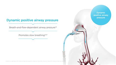 How does Optiflow High Flow work? Mechanisms of action – Dynamic positive airway pressure - YouTube