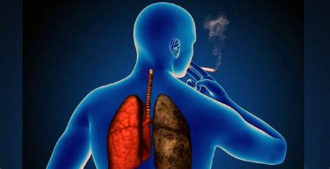 Enfermedad pulmonar obstructiva crónica (EPOC) y como tratarla con la comida