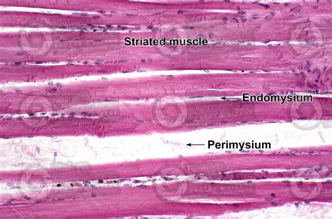 Skeletal Muscle Histology Labeled