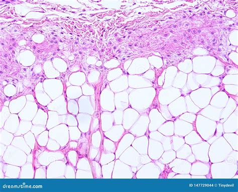 Histology Of Epiglottis Human Tissue Stock Photo | CartoonDealer.com ...