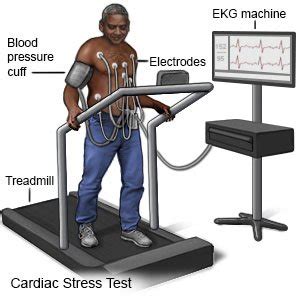 Cardiac Stress Test - What You Need to Know