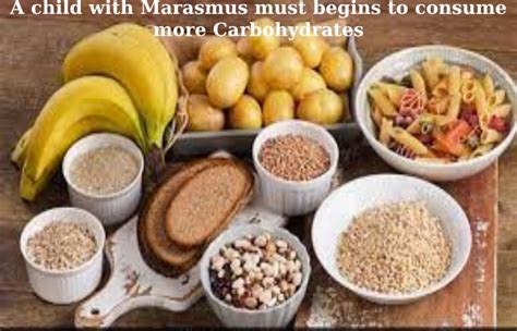 Marasmus – Symptoms, Causes, Risks, How is It Treated?