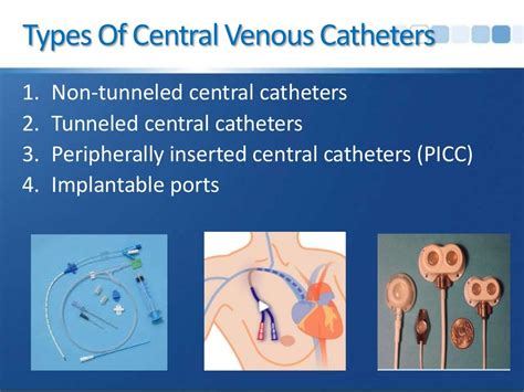 Central Venous Access