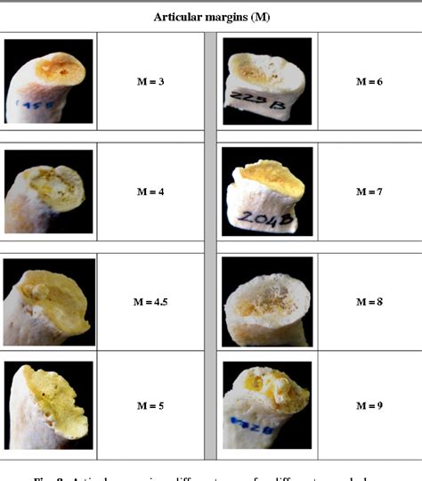 Figure 1 from Age-at-death estimation in Caucasian females from the ...