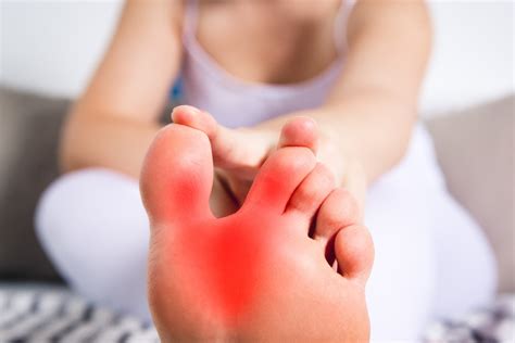 7 Home Remedies for Gout Foot & Toe Pain | Fort Myers Podiatrist