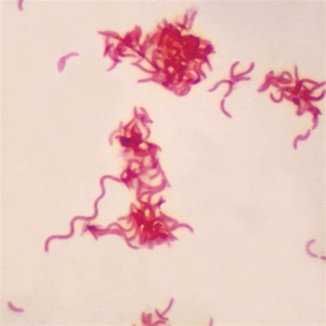 Gram-Negative Spirillum, w.m. Gram stain Microscope Slide | Carolina Biological Supply