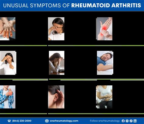 9 Unusual Symptoms of Rheumatoid Arthritis Revealed