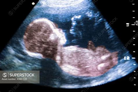 A Healthy Second Trimester Fetus as Seen Via Ultrasound - SuperStock