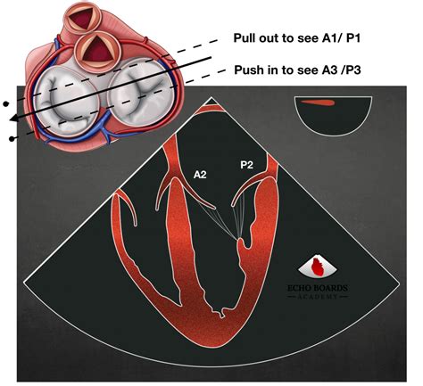 Mitral Valve Anatomy | EchoBoardsAcademy