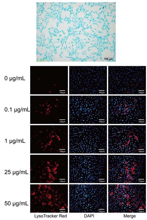 (A) Chondrocytes were stained with alcian blue staining. (B )The ...