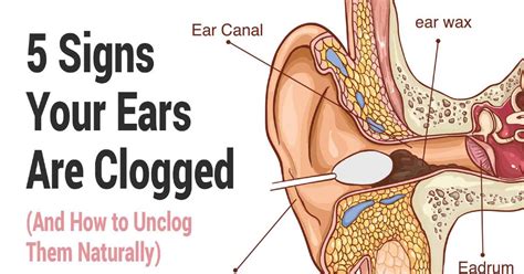 Signs Of Clogged Ears And How To Unclog Them - Kaiser Magazine