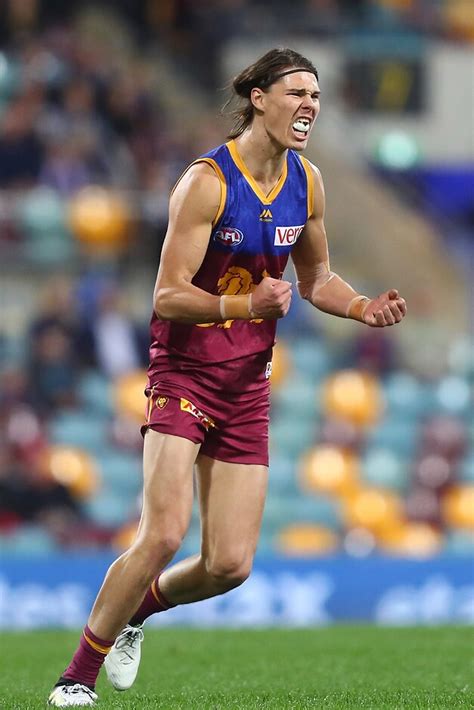 Lion beats infection but young star in doubt - AFL.com.au