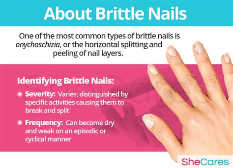 Top 100 + What causes dry brittle nails - Architectures-eric-boucher.com