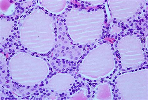 3-22 Tecido epitelial glandular - HISTOLOGIA