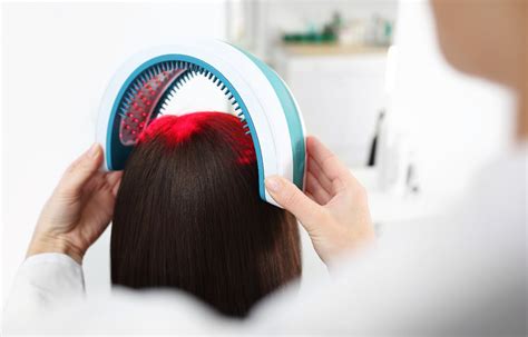 Laser Therapy for Hair Loss: How Does It Work? – myUpchar Ayurveda