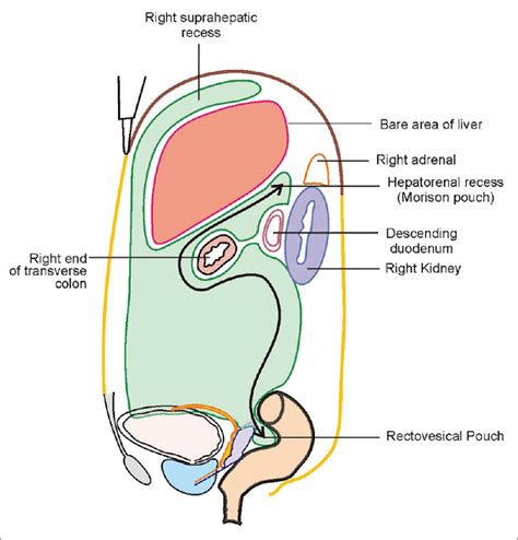 Medical Terms & Сlinical Сases : March 2021