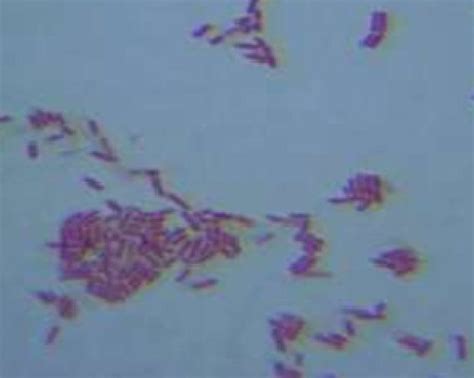 light microscope photos of B. thuringiensis | Download Scientific Diagram