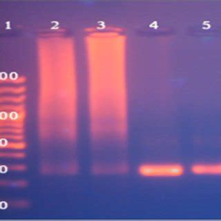 Agarose gel electrophoresis of PCR showing amplification of 270 bp of... | Download Scientific ...