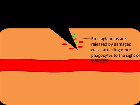 PPT - Inflammation PowerPoint Presentation, free download - ID:2118909