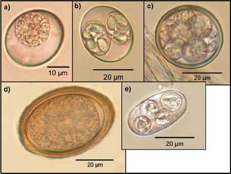 Coccidia oocysts: Cystoisospora species (a, b), coccidia oocyst with... | Download Scientific ...