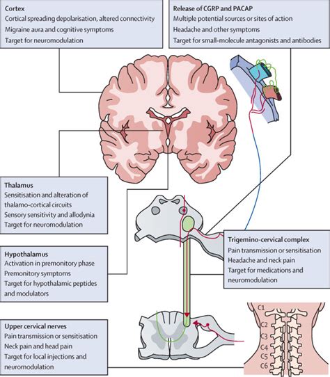 The pathophysiology of migraine: implications for clinical management ...