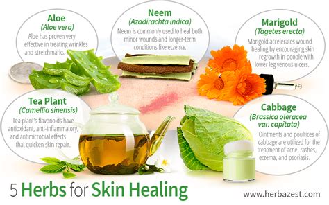 5 Herbs for Skin Healing | HerbaZest