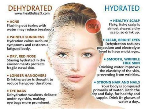 Dehydrated-Vs-Hydrated