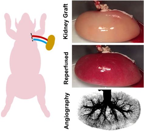 Frontiers | Sustained in vivo perfusion of a re-endothelialized tissue ...