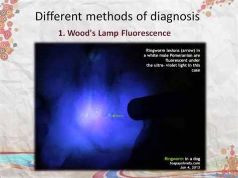 Dermatophytosis - 4 methods of diagnosis - YouTube