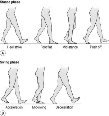 Abnormal gait | Basicmedical Key