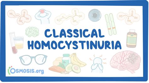 Classical homocystinuria (NORD): Video, Causes, & Meaning | Osmosis