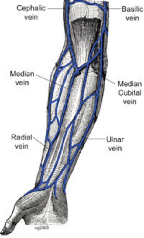 cephalic vein thrombus - ModernHeal.com