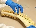 Polymer Implant Expands to Fill Gaps in the Spine