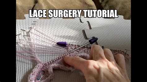 Lace Surgery Tutorial...The most enjoyable surgery I've ever had.... - YouTube