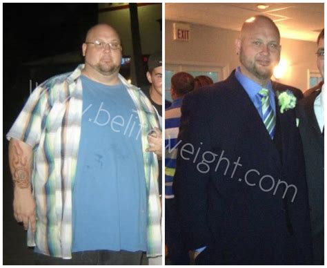 Brian's Long Term Gastric Sleeve Success Story - BeLiteWeight | Weight Loss Services