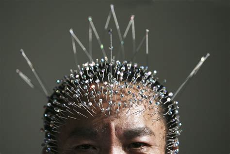 Quackademic medicine triumphant (yet again): A defense of acupuncture on the Harvard Health Blog ...