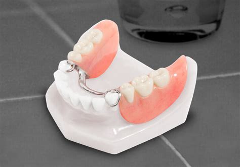 Services - Cast Partial Dentures| Arihant Advanced Cosmetic & Beauty ...