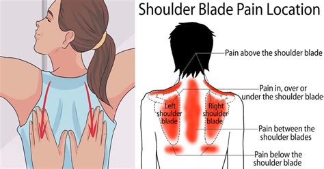 Pain Between Shoulder Blades = Cancer??