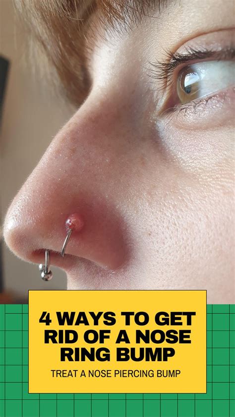 4 Things to Treat Infected Nose Piercing Bump Without Closing It in 2021 | Nose piercing bump ...