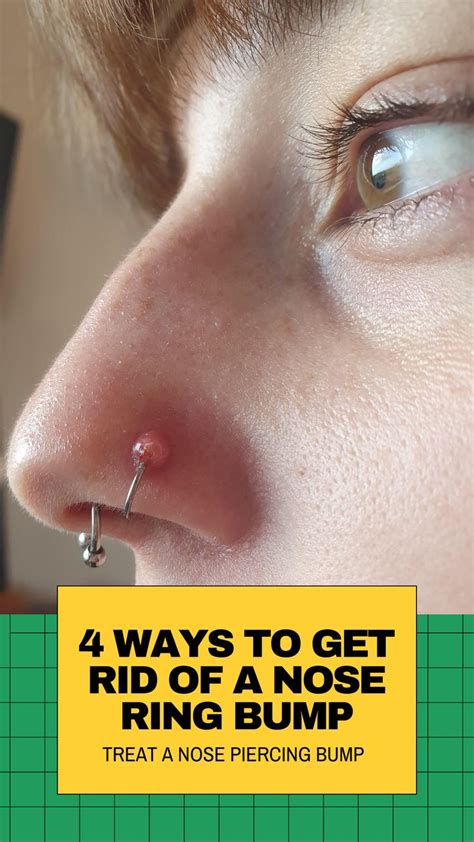 4 Things to Treat Infected Nose Piercing Bump Without Closing It | Nose ...