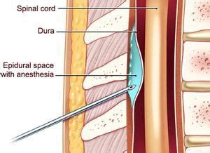 Pin on MEDICAL INFORMATION