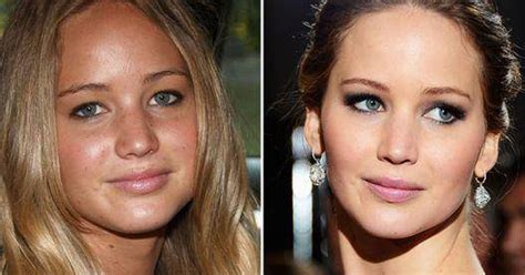 Jennifer Lawrence had plastic surgery after seeing these before and ...