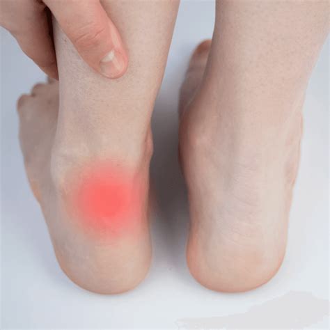 Achilles Tendinopathy: Causes, Symptoms & Treatment | The Feet People Podiatry