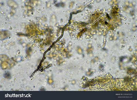 Fungal Fungi Hyphae Under Microscope Soil Stock Photo 2183425211 ...