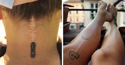 211 Amazing Tattoos That Turn Scars Into Works Of Art | Bored Panda