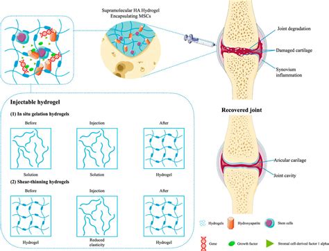 Frontiers | Therapeutic application of hydrogels for bone-related diseases