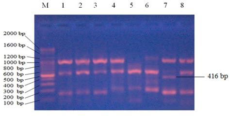 Gel electrophoresis of oxc gene of O. formigenes from stool samples of... | Download Scientific ...